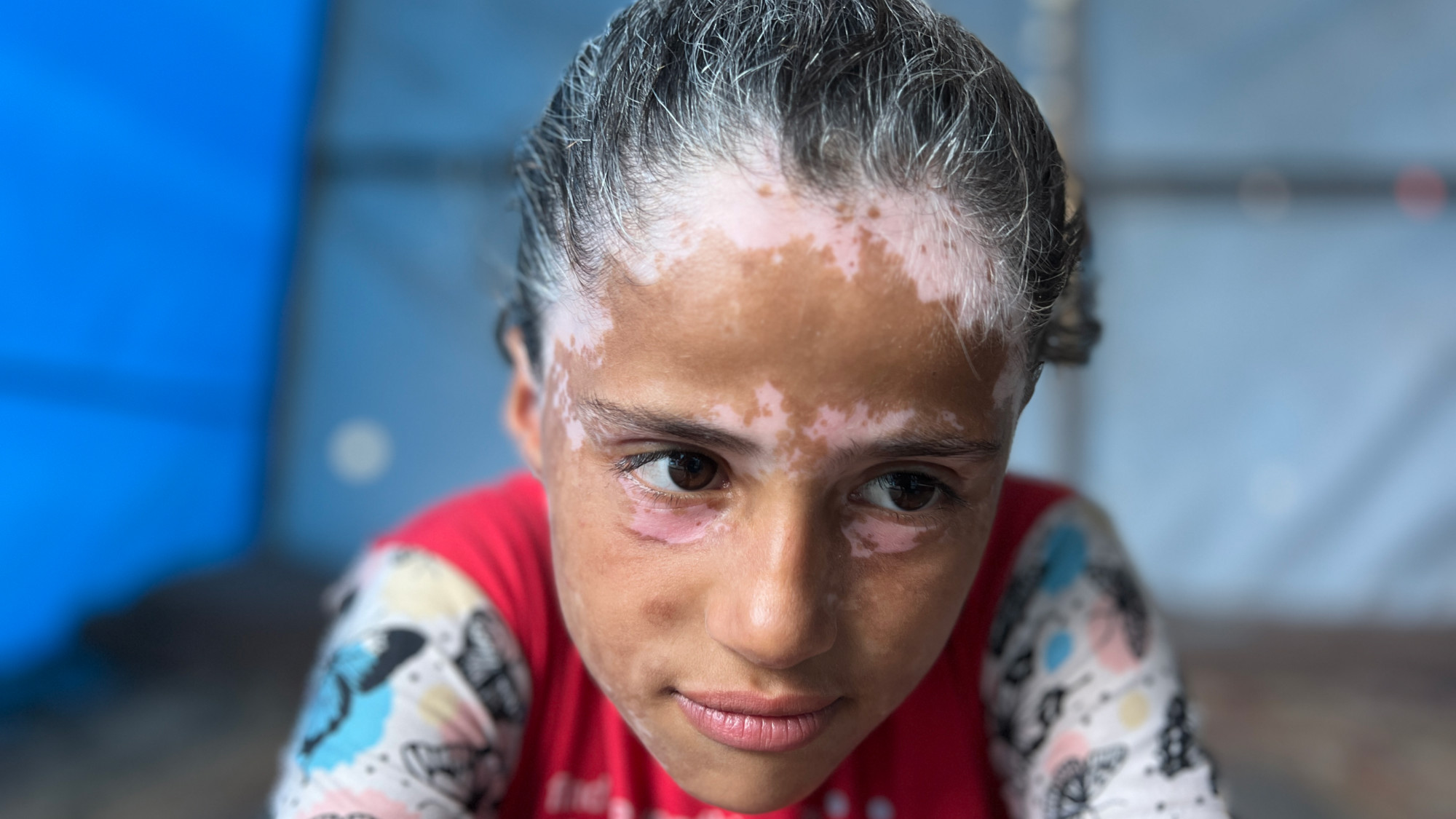 Elderly child: Trauma of Israeli bombing turns Gaza girls hair grey020 Elderly child: Trauma of Israeli bombing turns Gaza girls hair grey